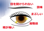 ドライアイ治療 富山市天正寺 岡本眼科