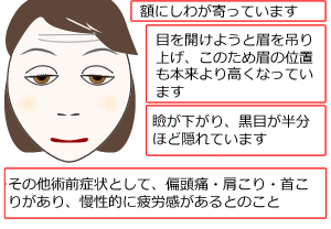 眼瞼下垂日帰り手術 富山市天正寺 岡本眼科（がんけんかすい）