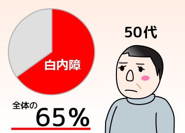 日帰り白内障手術 加齢性白内障は50代で約65％ 富山で白内障日帰り手術 岡本眼科