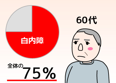 日帰り白内障手術 加齢性白内障は60代で約75％ 富山で白内障日帰り手術 岡本眼科