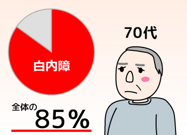 日帰り白内障手術 加齢性白内障は70代で約85％ 富山で白内障日帰り手術 岡本眼科