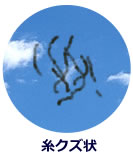 飛蚊症とは、明るい所や白い壁などを見つめたときに、虫や糸くずのような浮遊物が飛んで見える状態