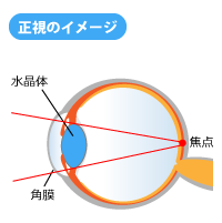 正視のイメージ