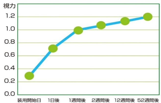 メルスプラン富山市天正寺 コンタクトレンズの販売（ハード、ソフト、ワンデー、乱視用コンタクトレンズ,遠視用コンタクトレンズ,カラーコンタクトレンズ）自宅配送