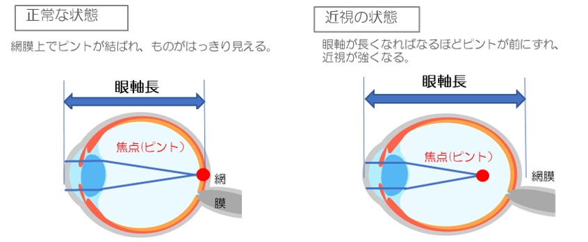 岡本眼科受付待合 岡本眼科　富山市天正寺 眼科専門医 オルソケラトロジーレンズについて