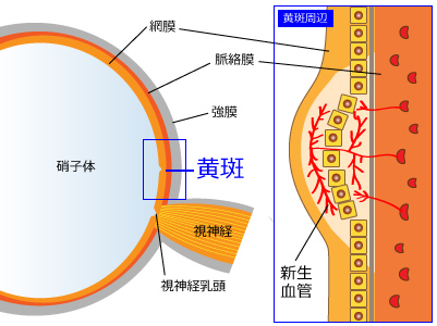 医師が説明する加齢黄斑変性  加齢黄斑変性の解説 加齢黄斑変性の治療 富山市天正寺 岡本眼科