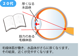 遠近両用コンタクトレンズ 遠視用コンタクトレンズ 富山市