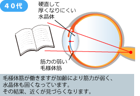 遠近両用コンタクトレンズ 遠視用コンタクトレンズ 富山市