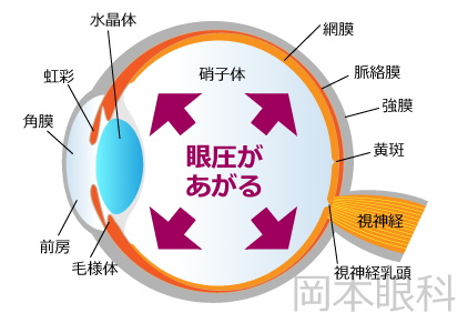 緑内障とは？緑内障の解説 緑内障の治療 富山市天正寺 岡本眼科 医師が説明する緑内障